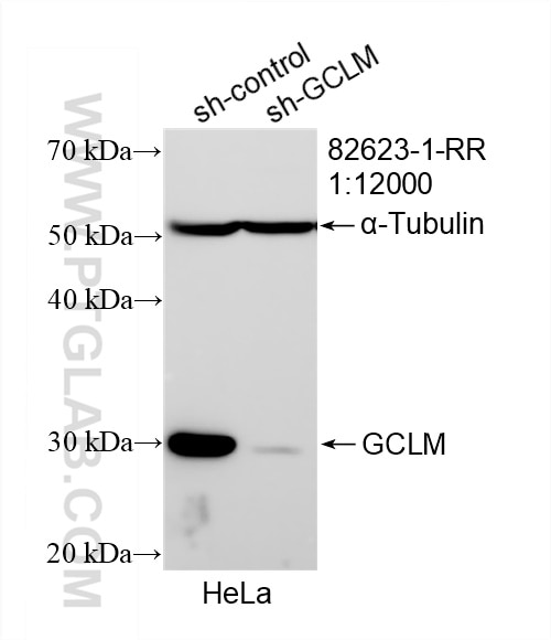 Western Blot (WB) analysis of HeLa cells using GCLM Recombinant antibody (82623-1-RR)