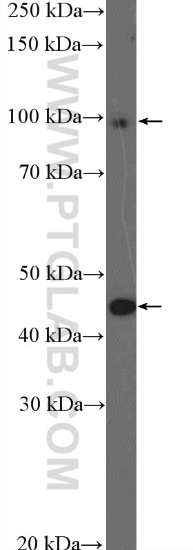 Western Blot (WB) analysis of HeLa cells using GCM1 Polyclonal antibody (21724-1-AP)