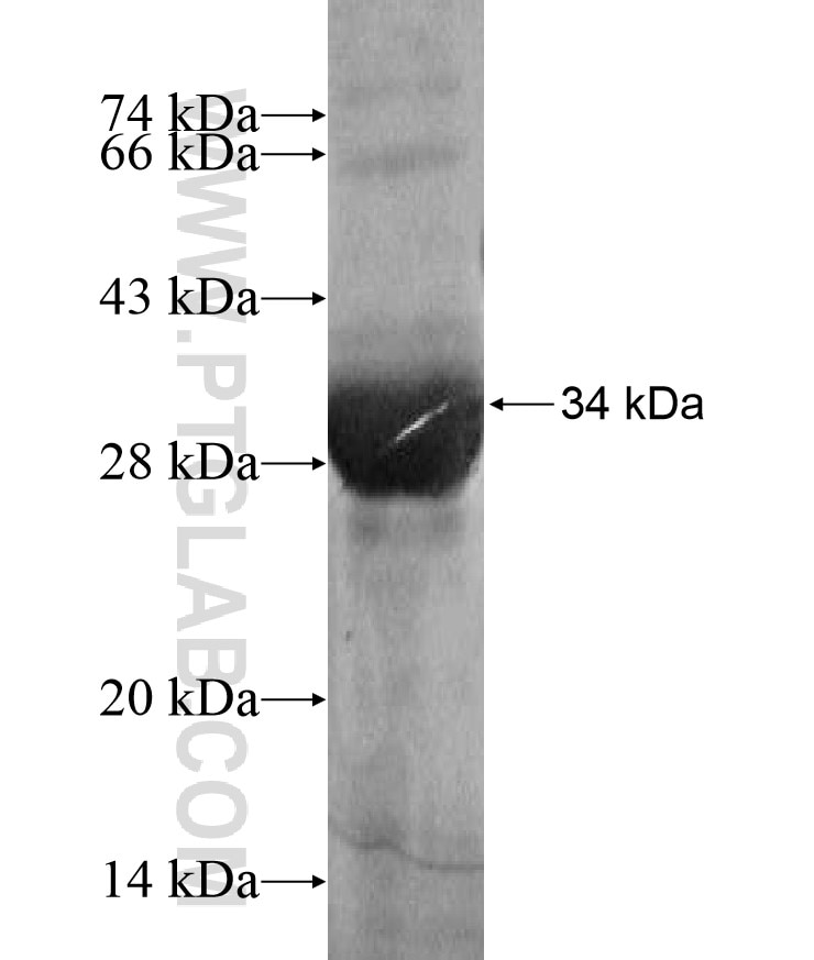 GCM1 fusion protein Ag17159 SDS-PAGE