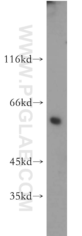 Western Blot (WB) analysis of human brain tissue using GCM2 Polyclonal antibody (21088-1-AP)