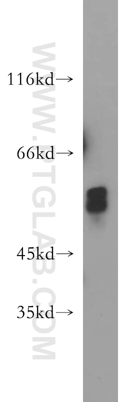 Western Blot (WB) analysis of HEK-293 cells using GCM2 Polyclonal antibody (21088-1-AP)