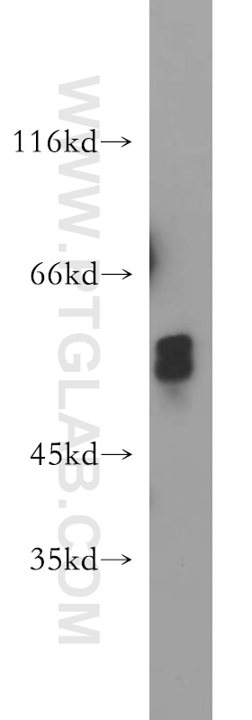 WB analysis of HEK-293 using 21088-1-AP