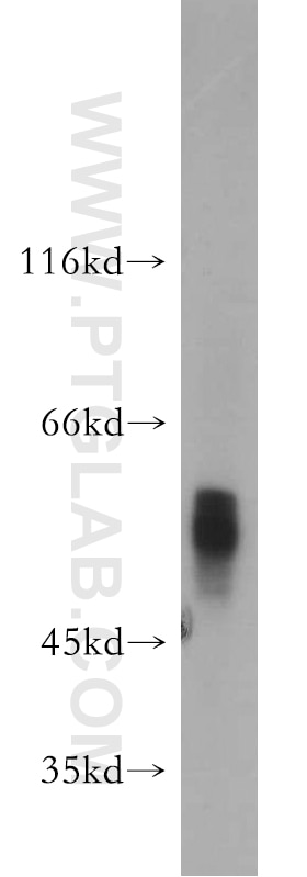 Western Blot (WB) analysis of mouse kidney tissue using GCM2 Polyclonal antibody (21088-1-AP)