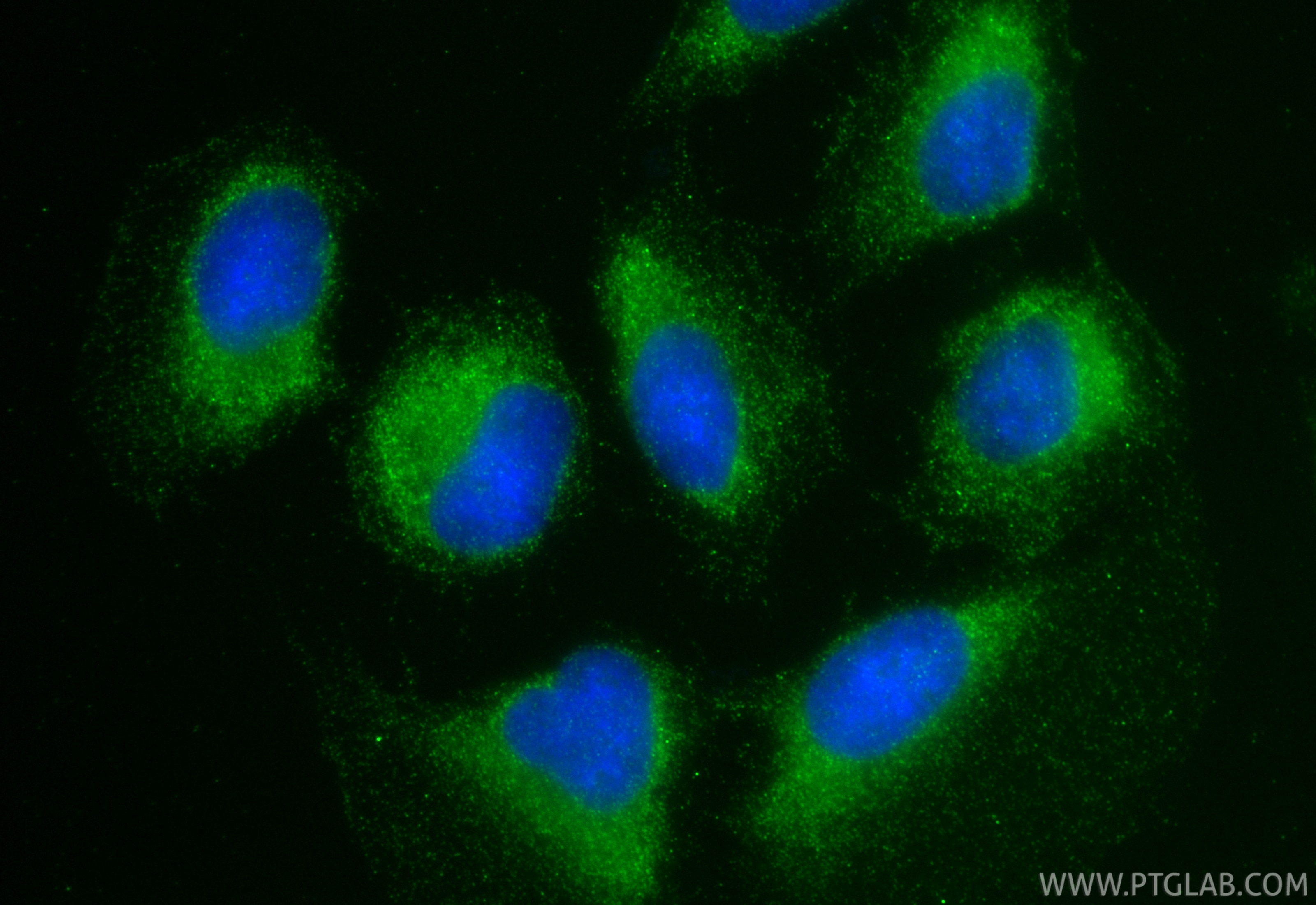 IF Staining of U2OS using 30993-1-AP Immunofluorescence (IF) / fluorescent staining of U2OS cells using GCN1 Polyclonal antibody (30993-1-AP)