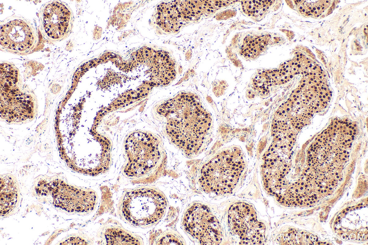 Immunohistochemistry (IHC) staining of human testis tissue using GCNA Polyclonal antibody (30693-1-AP)
