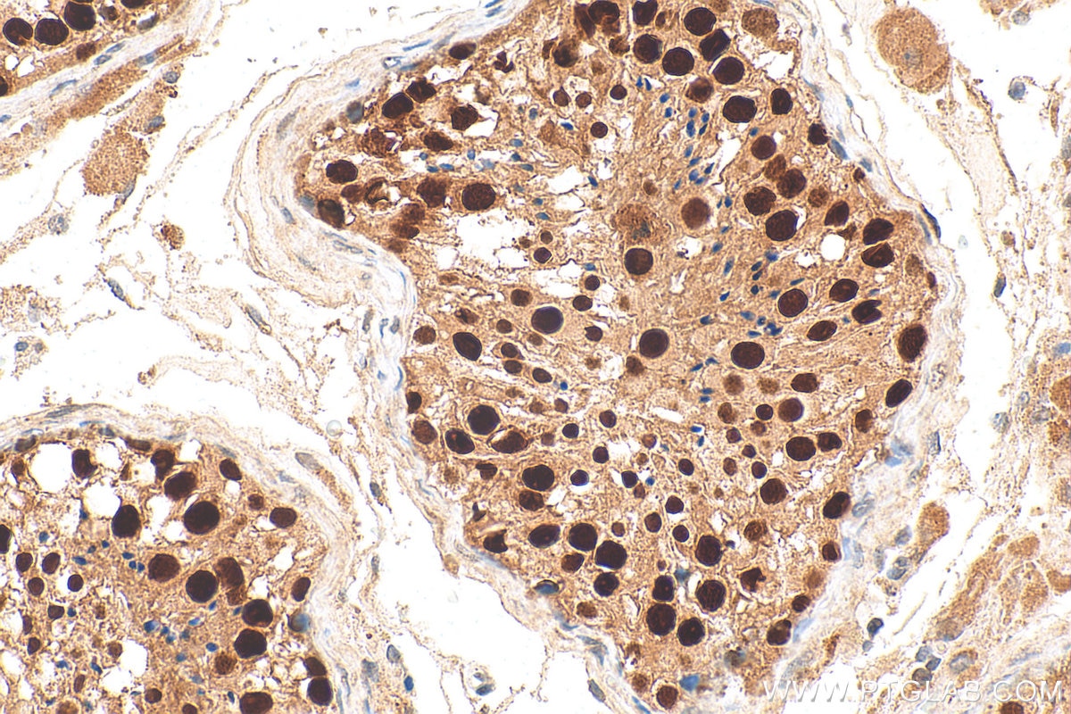 Immunohistochemistry (IHC) staining of human testis tissue using GCNA Polyclonal antibody (30693-1-AP)