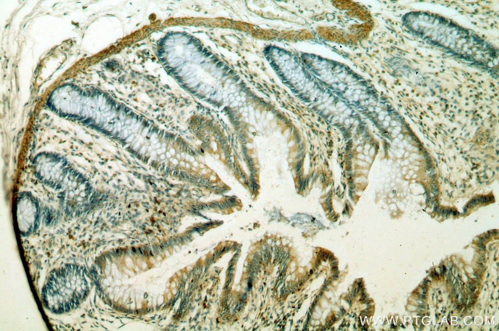 Immunohistochemistry (IHC) staining of human colon tissue using GCNT2 Polyclonal antibody (18118-1-AP)