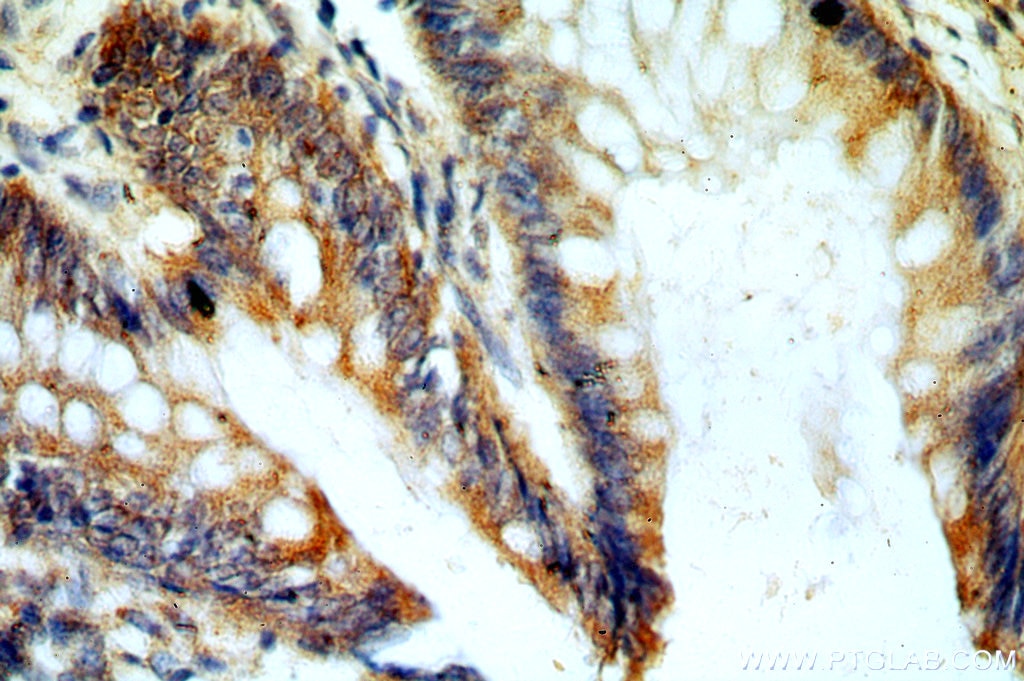 Immunohistochemistry (IHC) staining of human colon tissue using GCNT2 Polyclonal antibody (18118-1-AP)