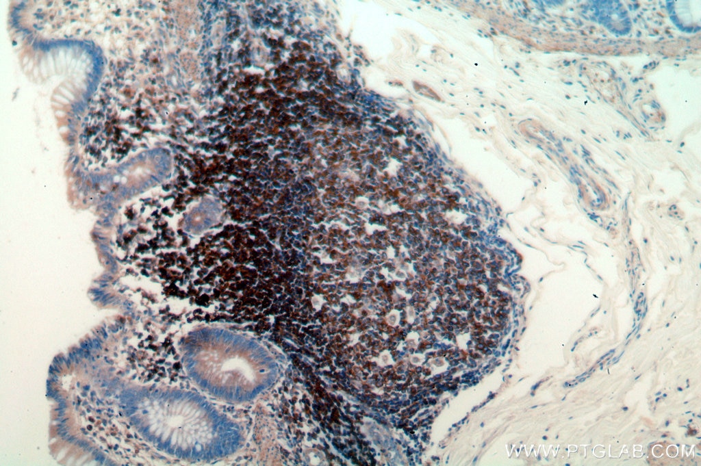 Immunohistochemistry (IHC) staining of human colon tissue using GCNT2 Polyclonal antibody (18118-1-AP)