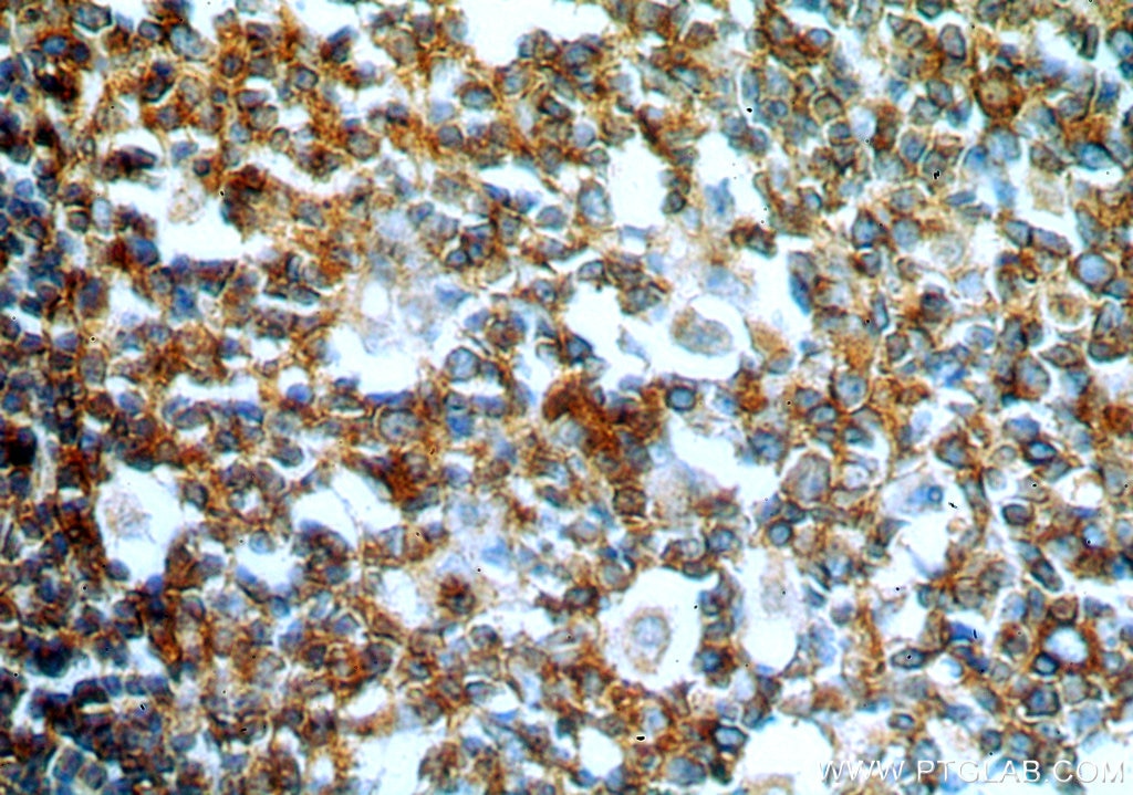 Immunohistochemistry (IHC) staining of human colon tissue using GCNT2 Polyclonal antibody (18118-1-AP)