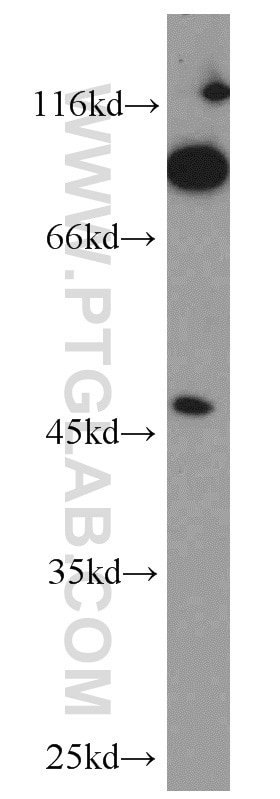 Western Blot (WB) analysis of mouse kidney tissue using GCNT2 Polyclonal antibody (18118-1-AP)