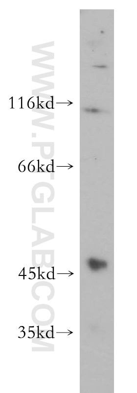 Western Blot (WB) analysis of HEK-293 cells using GCNT2 Polyclonal antibody (18118-1-AP)