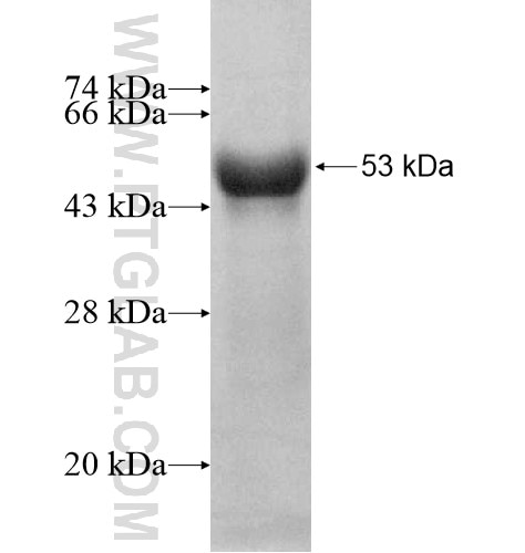 GCNT3 fusion protein Ag10663 SDS-PAGE
