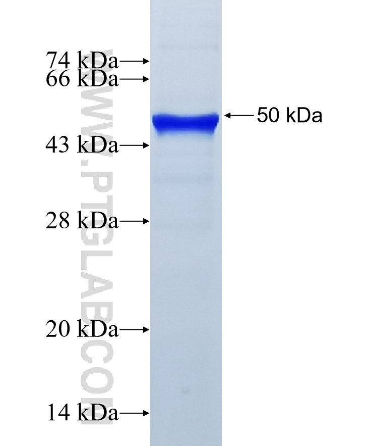 GCNT3 fusion protein Ag10663 SDS-PAGE