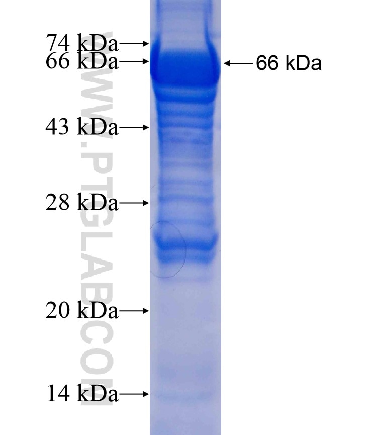 GCNT3 fusion protein Ag10765 SDS-PAGE