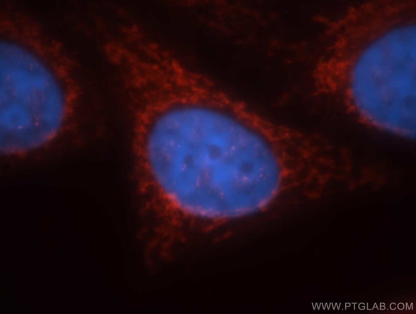 Immunofluorescence (IF) / fluorescent staining of HepG2 cells using GCOM1 Polyclonal antibody (18129-1-AP)