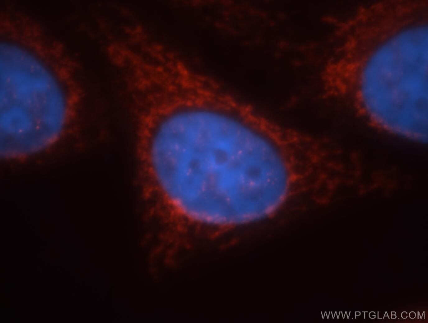 Immunofluorescence (IF) / fluorescent staining of HepG2 cells using GCOM1 Polyclonal antibody (18129-1-AP)