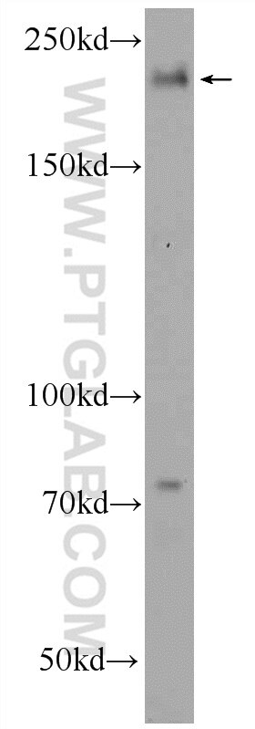 Western Blot (WB) analysis of HEK-293 cells using GCP6 Polyclonal antibody (25022-1-AP)