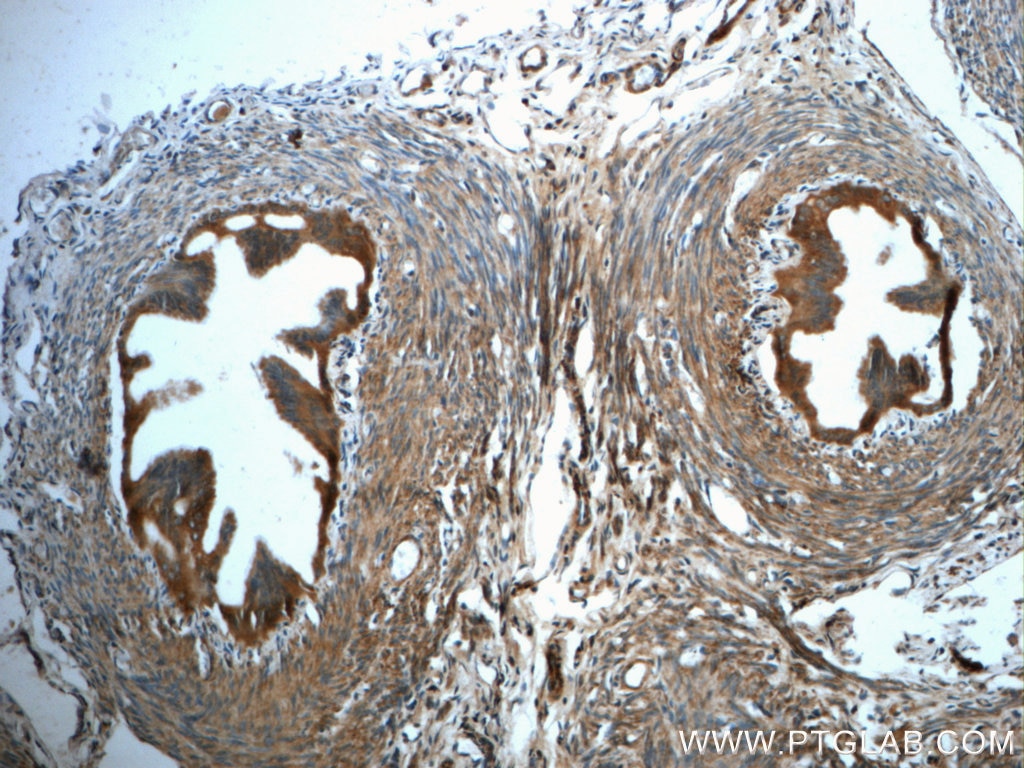 Immunohistochemistry (IHC) staining of rat ovary tissue using GCSH Polyclonal antibody (16726-1-AP)