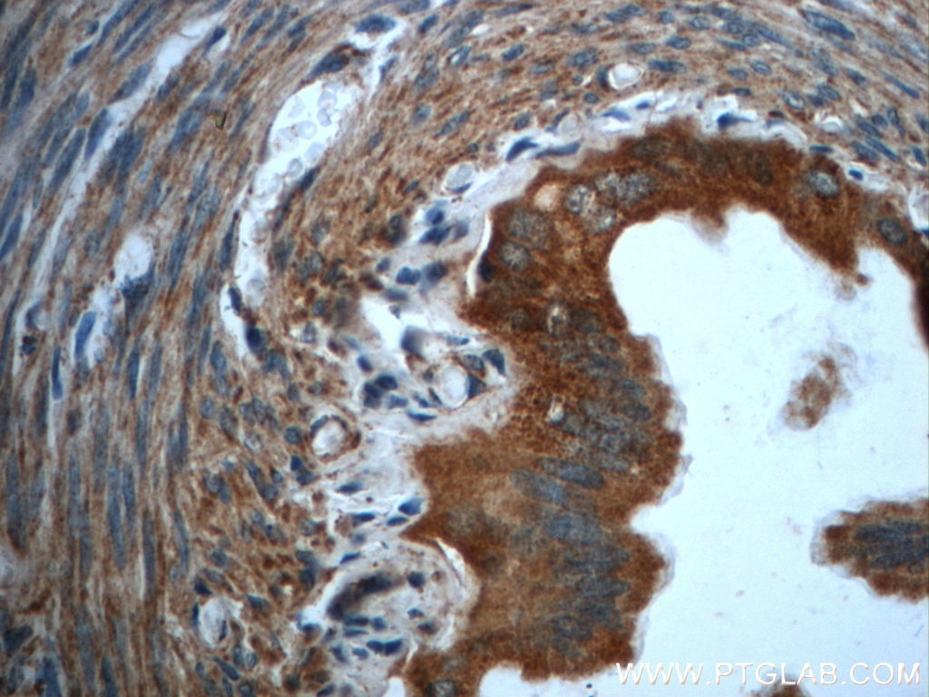 Immunohistochemistry (IHC) staining of rat ovary tissue using GCSH Polyclonal antibody (16726-1-AP)