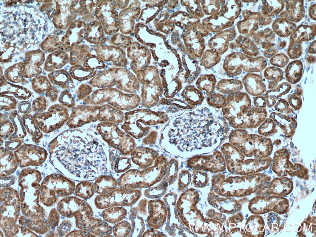 IHC staining of human kidney using 16726-1-AP