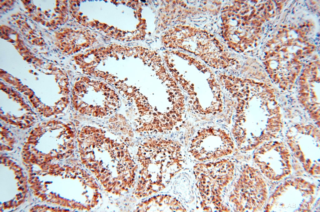 Immunohistochemistry (IHC) staining of human testis tissue using GCSH Polyclonal antibody (16726-1-AP)