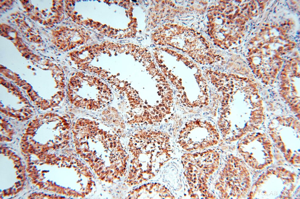 IHC staining of human testis using 16726-1-AP