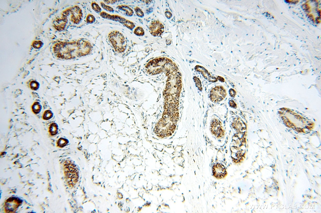 Immunohistochemistry (IHC) staining of human skin tissue using GCSH Polyclonal antibody (16726-1-AP)