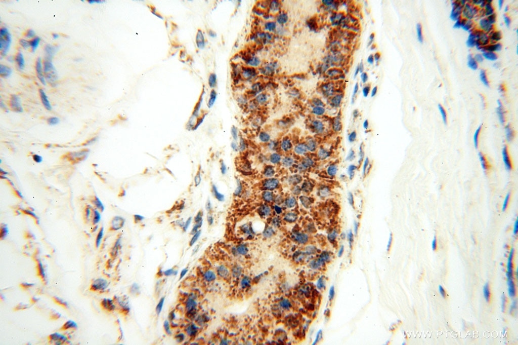 Immunohistochemistry (IHC) staining of human skin tissue using GCSH Polyclonal antibody (16726-1-AP)