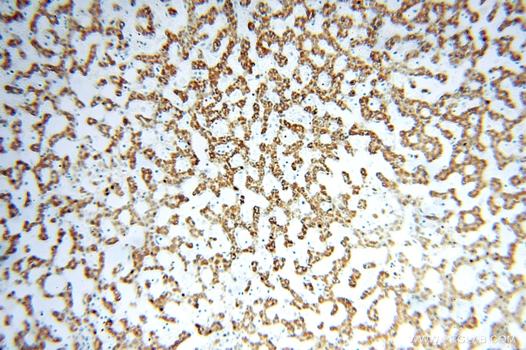 Immunohistochemistry (IHC) staining of human liver tissue using GCSH Polyclonal antibody (16726-1-AP)