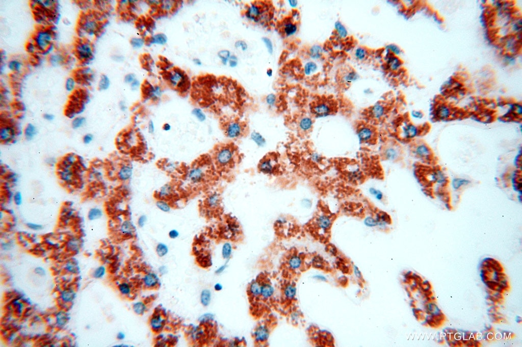 Immunohistochemistry (IHC) staining of human liver tissue using GCSH Polyclonal antibody (16726-1-AP)