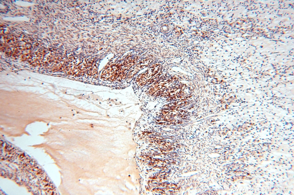 Immunohistochemistry (IHC) staining of human ovary tissue using GCSH Polyclonal antibody (16726-1-AP)