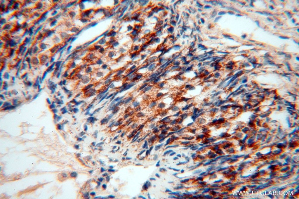 Immunohistochemistry (IHC) staining of human ovary tissue using GCSH Polyclonal antibody (16726-1-AP)