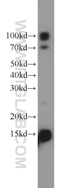 WB analysis of mouse brain using 16726-1-AP