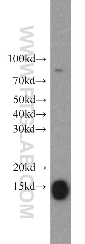 WB analysis of mouse kidney using 16726-1-AP