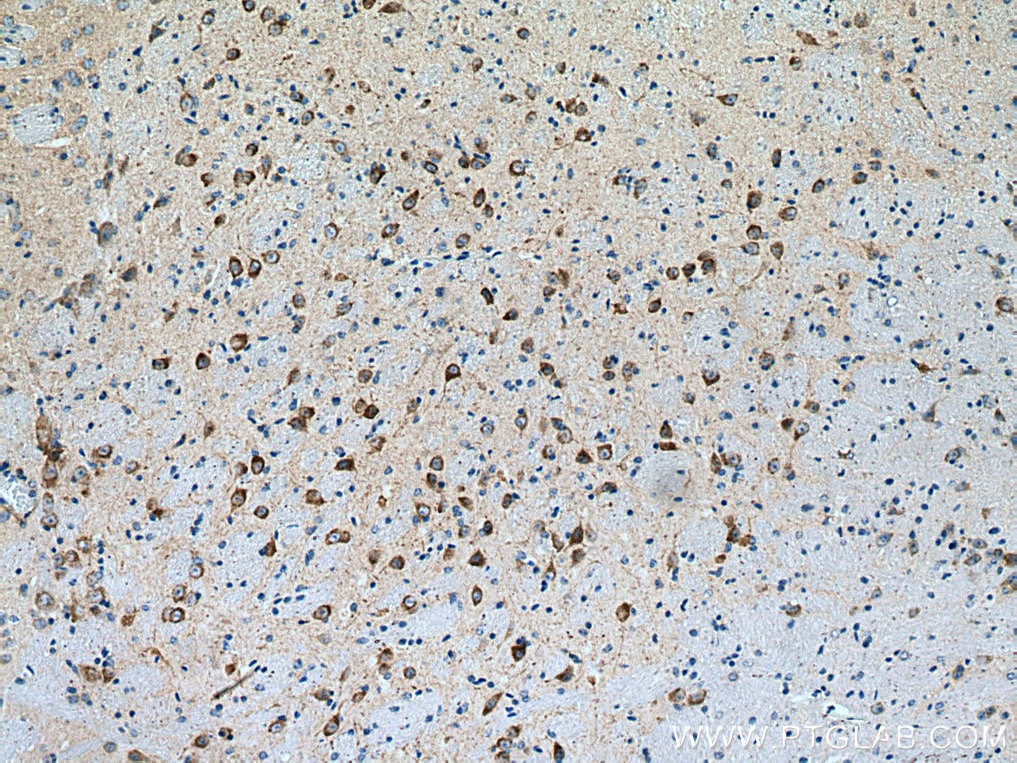 Immunohistochemistry (IHC) staining of mouse brain tissue using GDAP1 Polyclonal antibody (13152-1-AP)