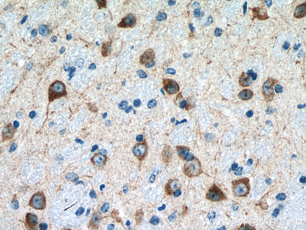 Immunohistochemistry (IHC) staining of mouse brain tissue using GDAP1 Polyclonal antibody (13152-1-AP)