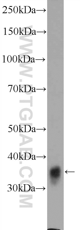 Western Blot (WB) analysis of fetal human brain tissue using GDAP1 Polyclonal antibody (13152-1-AP)