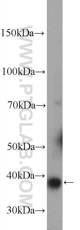Western Blot (WB) analysis of mouse brain tissue using GDAP1 Polyclonal antibody (13152-1-AP)