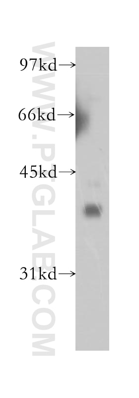Western Blot (WB) analysis of human brain tissue using GDAP1 Polyclonal antibody (13152-1-AP)