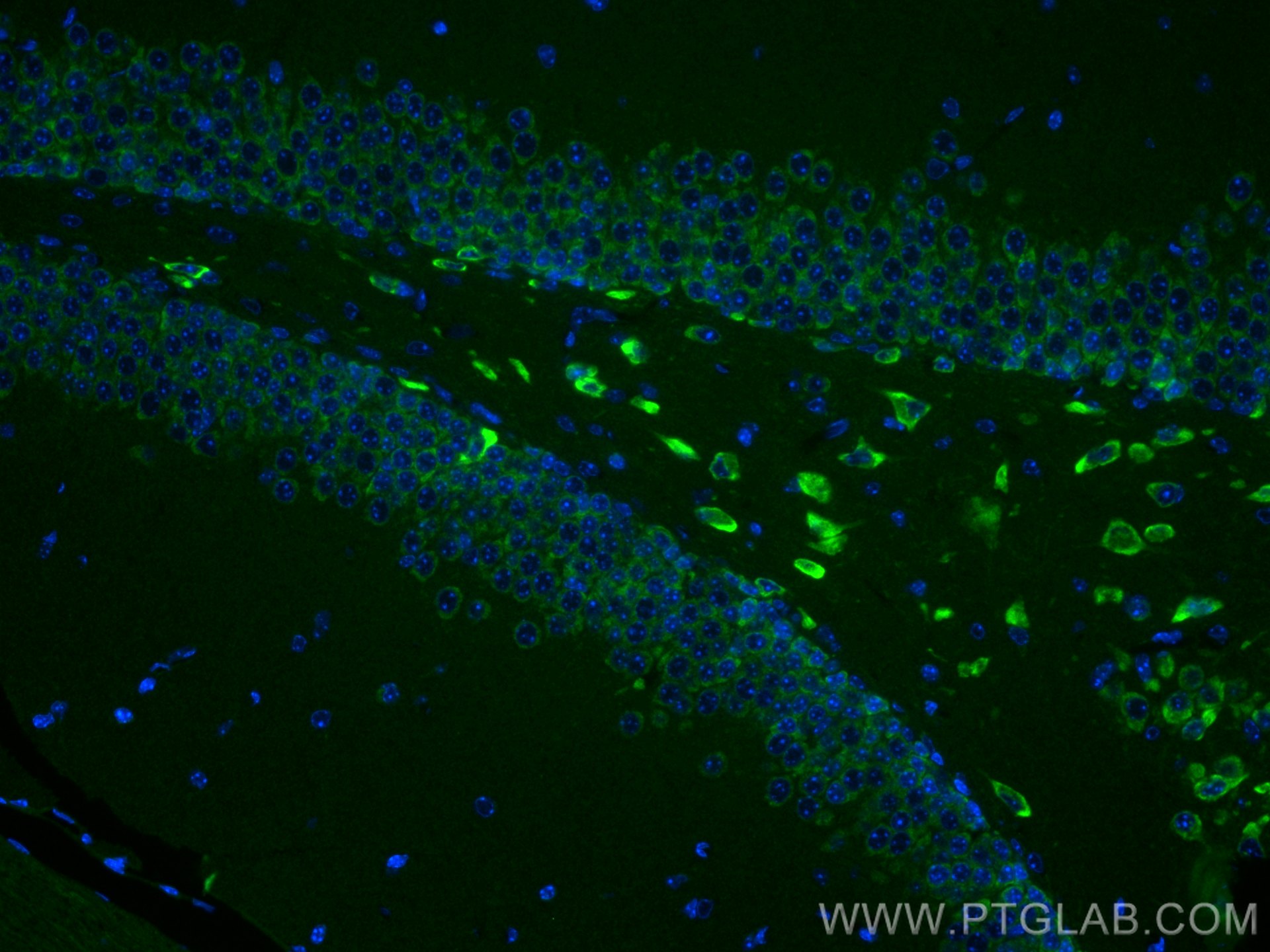 Immunofluorescence (IF) / fluorescent staining of mouse brain tissue using GDAP1 Monoclonal antibody (68083-1-Ig)