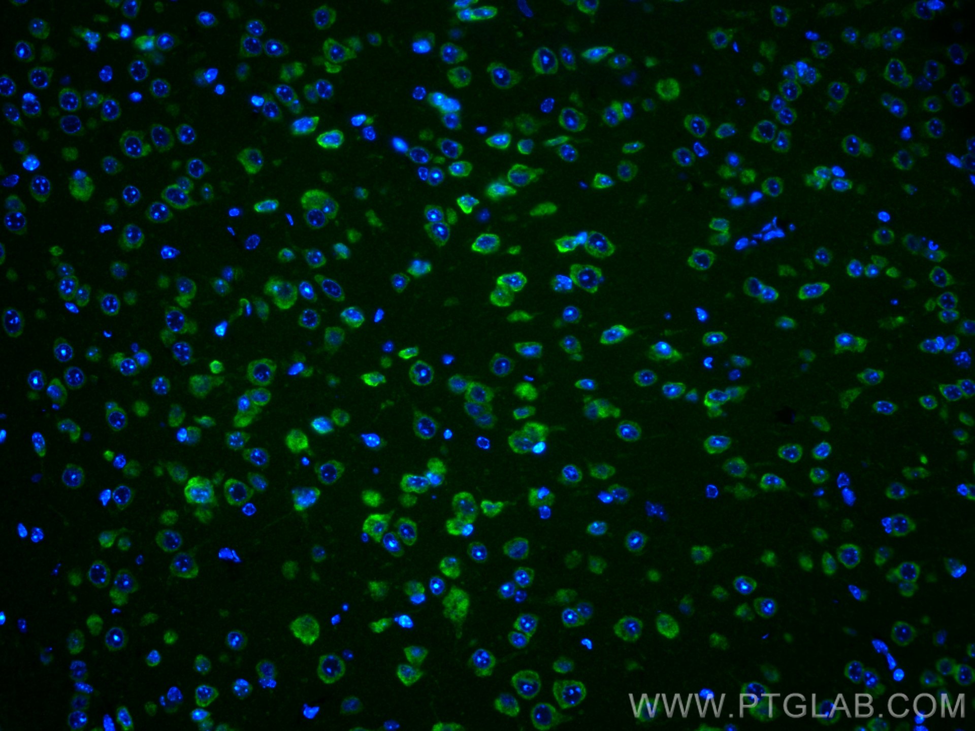 Immunofluorescence (IF) / fluorescent staining of mouse brain tissue using GDAP1 Monoclonal antibody (68083-1-Ig)