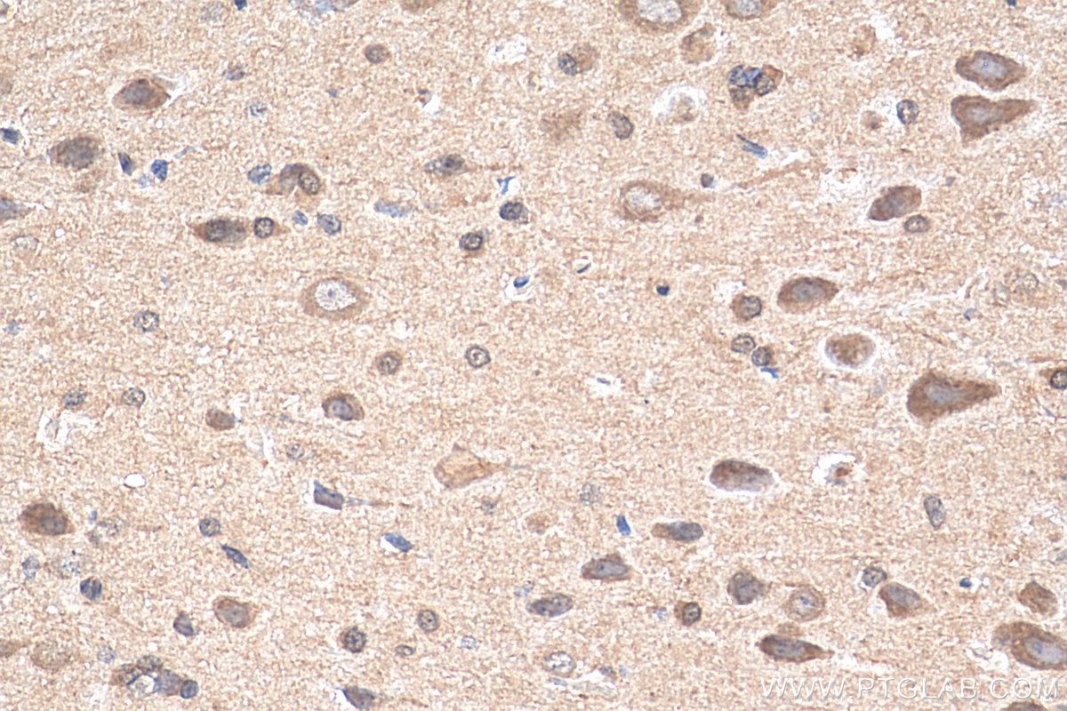 Immunohistochemistry (IHC) staining of rat brain tissue using GDAP1 Monoclonal antibody (68083-1-Ig)