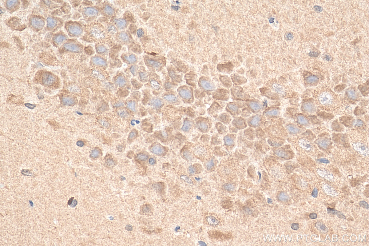 Immunohistochemistry (IHC) staining of rat brain tissue using GDAP1 Monoclonal antibody (68083-1-Ig)
