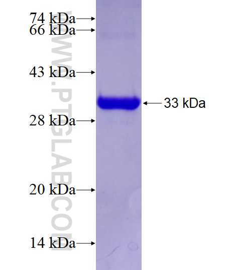 GDAP1 fusion protein Ag28616 SDS-PAGE