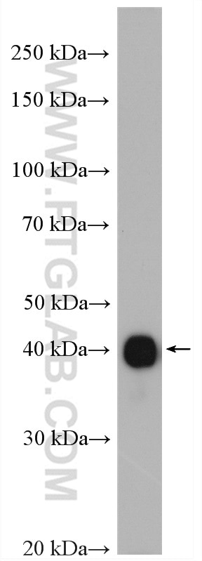 Western Blot (WB) analysis of mouse brain tissue using GDAP1L1 Polyclonal antibody (11977-1-AP)
