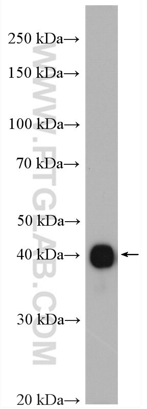 Western Blot (WB) analysis of mouse brain tissue using GDAP1L1 Polyclonal antibody (11977-1-AP)