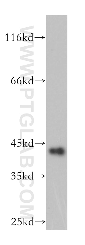 Western Blot (WB) analysis of Y79 cells using GDAP1L1 Polyclonal antibody (11977-1-AP)