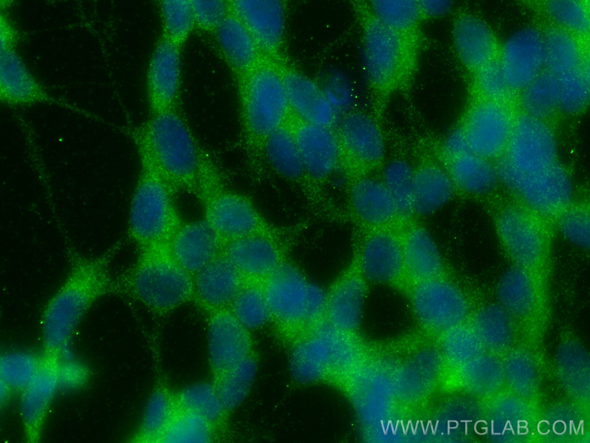 Immunofluorescence (IF) / fluorescent staining of SH-SY5Y cells using GDAP1L1 Monoclonal antibody (68340-1-Ig)