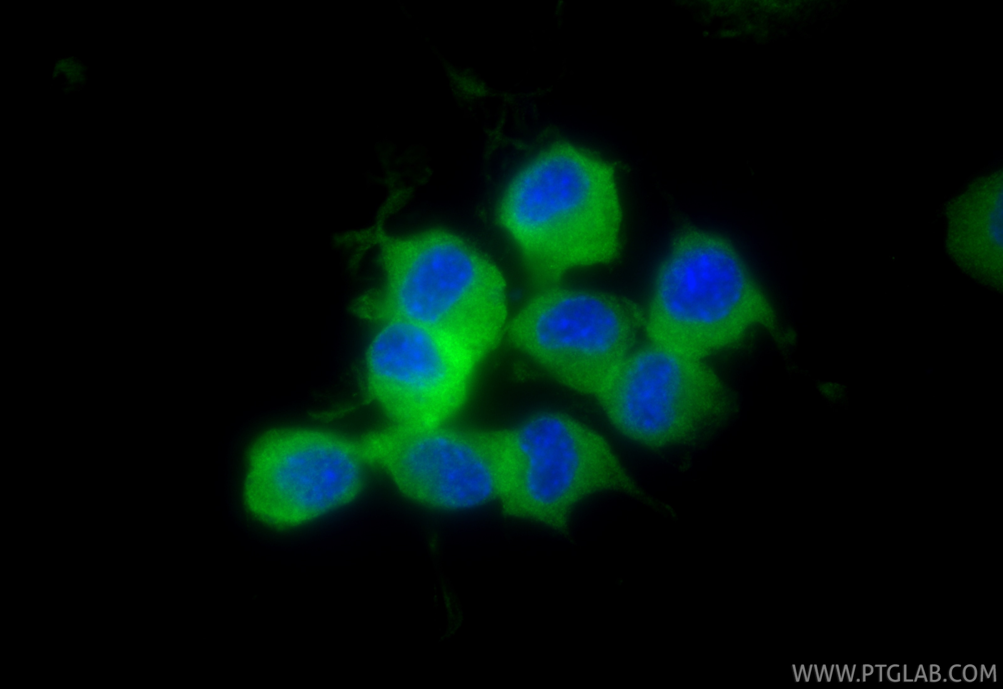 Immunofluorescence (IF) / fluorescent staining of Neuro-2a cells using GDAP1L1 Monoclonal antibody (68340-1-Ig)